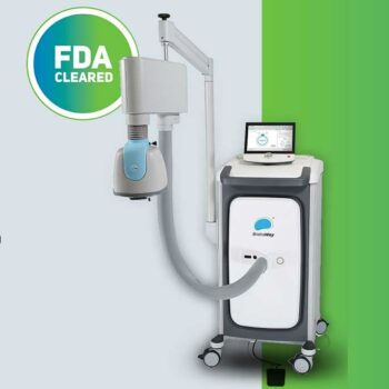 TMS treatment